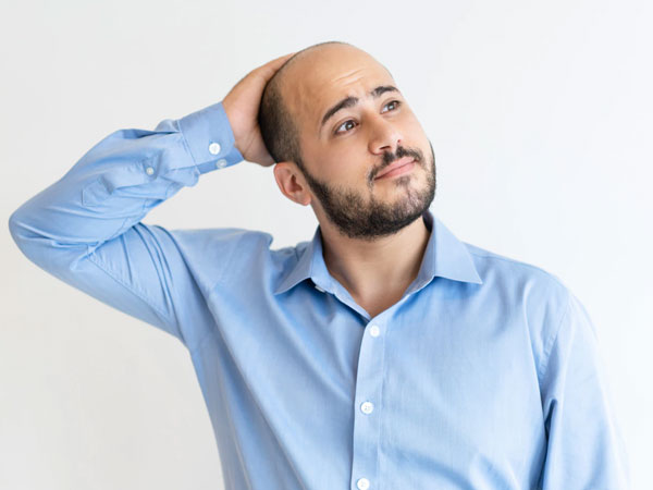 पुरुषों में बालों का झड़ना Hair loss Tips in men