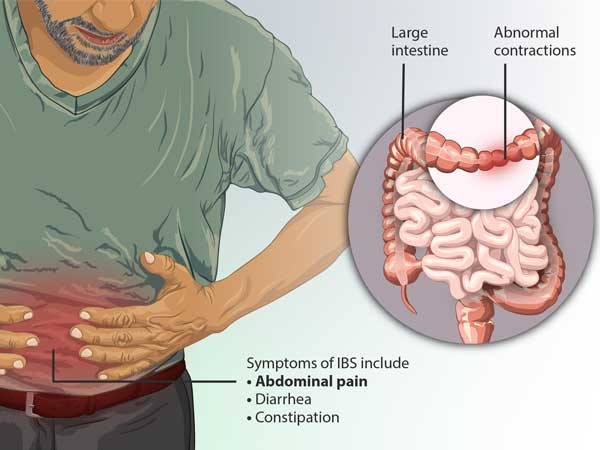 Symptoms-of-abdominal-pain