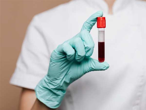 Diagnosis-of-Hemoglobin-test