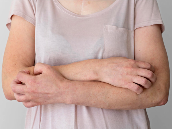 Skin rough and itchy is kidney disease symptoms