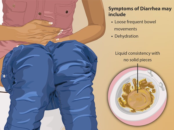 What are the symptoms of Diarrhea in Hindi