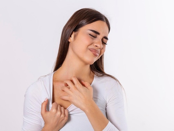 एक्जिमा के लक्षण क्या हैं? Eczema Symptoms in Hindi