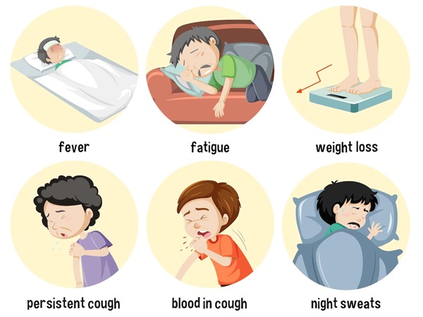 Tuberculosis-(TB)-Symptoms