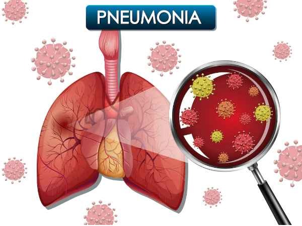What is Pneumonia in Hindi