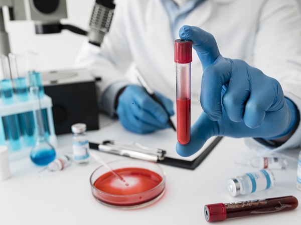 What is a CEA blood test and why is it done?