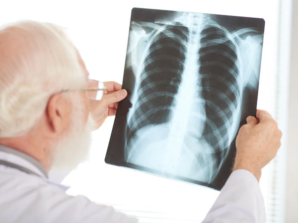 Pneumonia 8 Types of Respiratory Diseases 