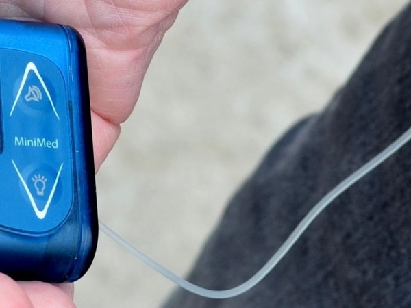 Tubes may get tugged Pros and Cons of Insulin Pump