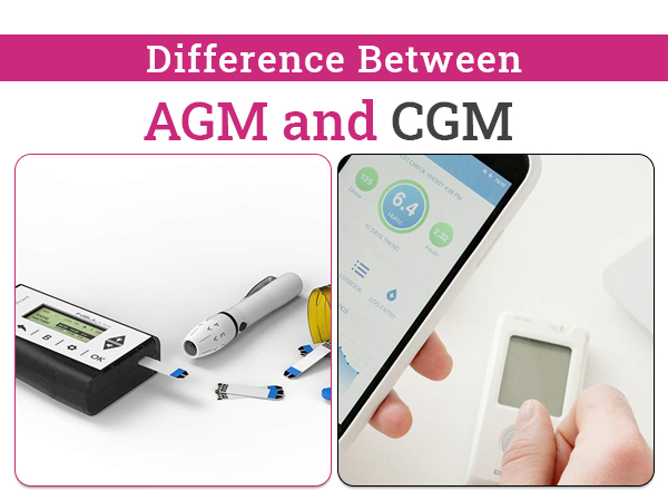 Difference Between AGM and CGM