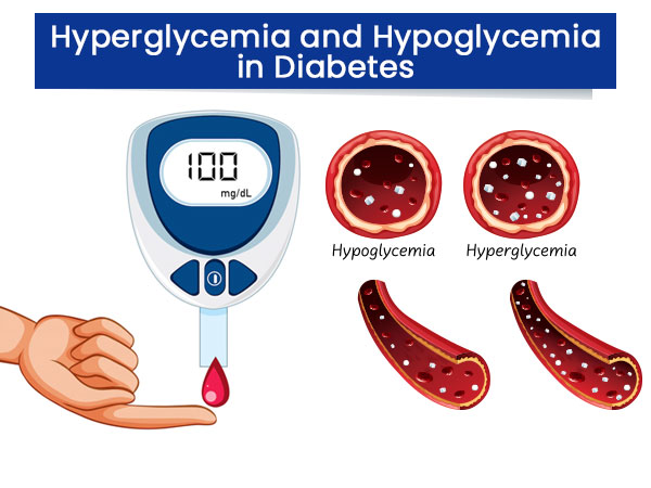 Hyperglycemia and Hypoglycemia in Diabetes