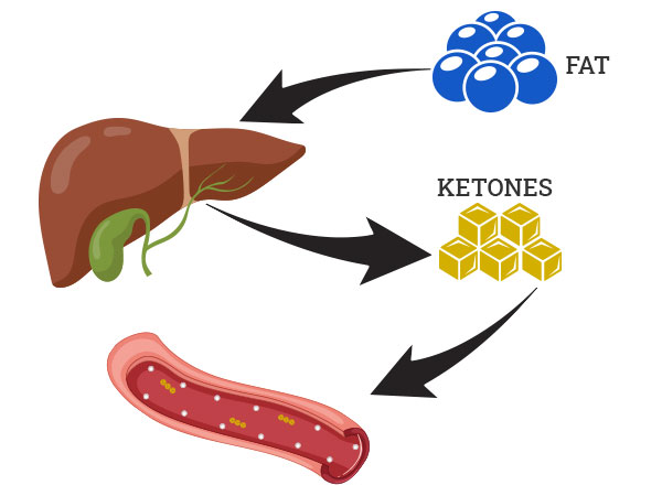 Ketosis