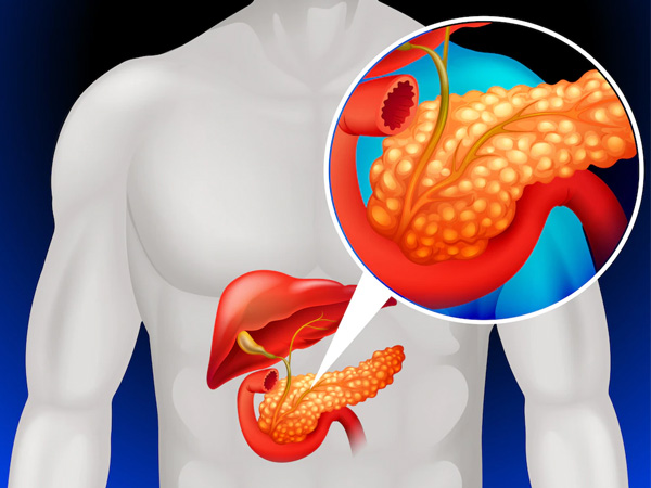 Diabetes Remission: Restoring Pancreas Functioning