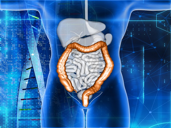 colon inflammation