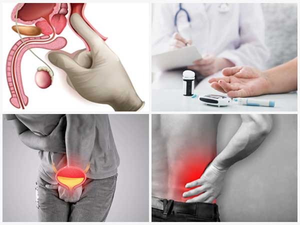 Frequent Urination In Men Its Diagnosis And Treatment Tv Health 