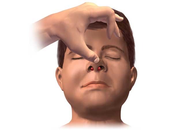 Deviated Nasal Septum Symptoms And Treatments TV Health