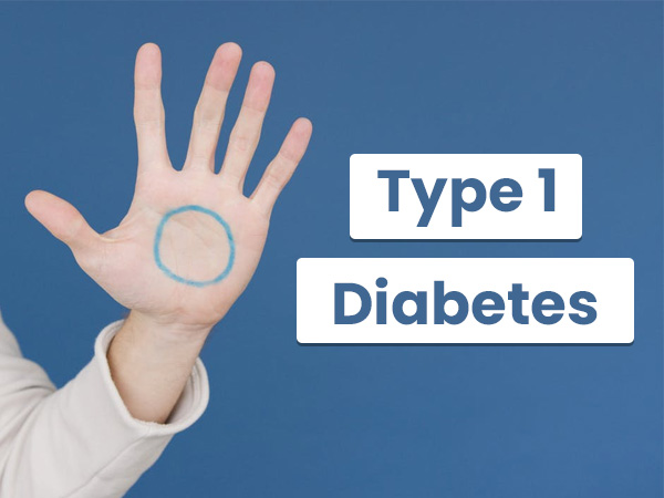 Type 1 Diabetes