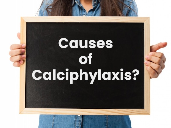 Causes-of-calciphylaxis