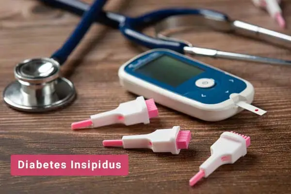 Diabetes-Insipidus