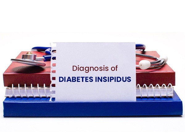 Diagnosis-of-Diabetes-Insipidus