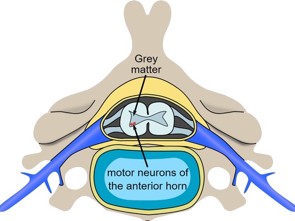 Get-Ahead-of-Motor-Neuron-Disease