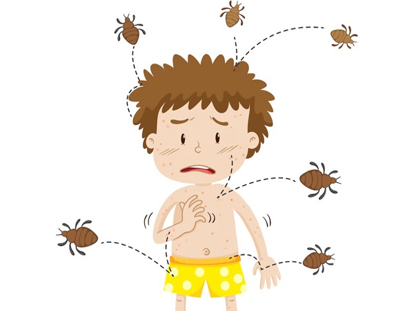 Symptoms Pubic Lice