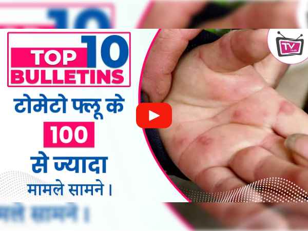 Top 10 Health News More than 100 cases of Tomato Flu
