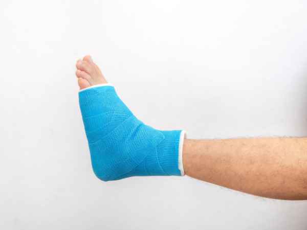 Below Are Some Tips On How To Treat Ankle Fracture