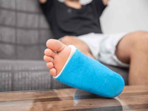 How To Treat Ankle Fracture At Home