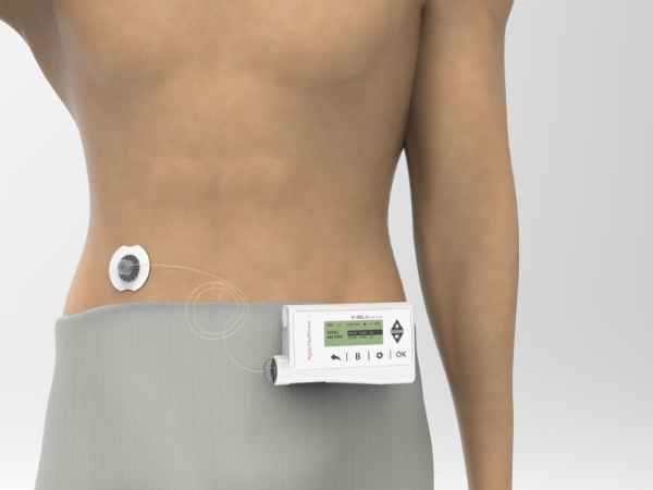 Machine To Control Diabetes Get Ahead of It!