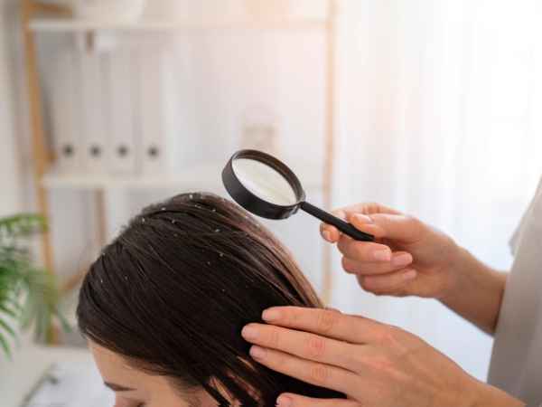 several types of hair loss. These include