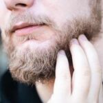 Beard Dandruff Best Home Remedies & Treatments