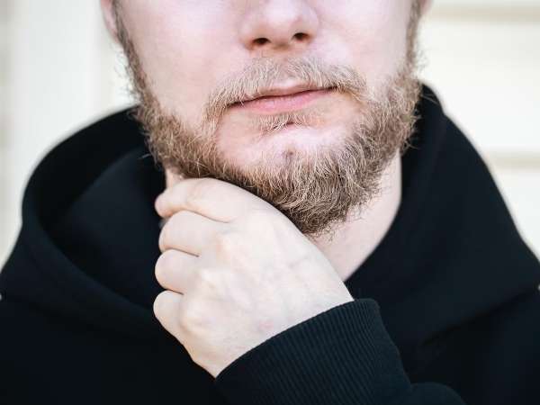 Beard Dandruff What Is It