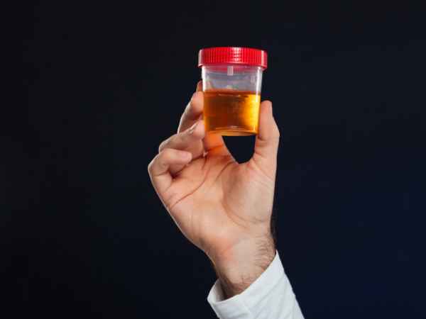 Burning Sensation In Urine Find Out What's Causing It!
