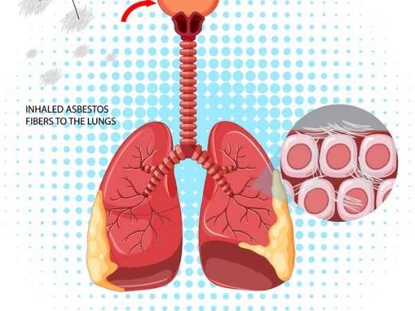 How Can I Manage My Symptoms Of COPD