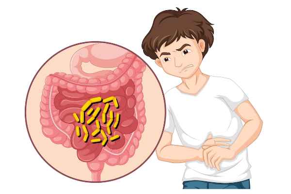 Introduction to Gastrointestinal Stromal Tumor (GIST)