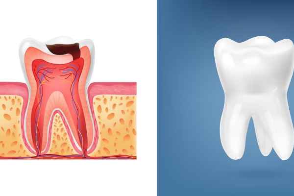 Tooth Enamel Common Myths Debunked!