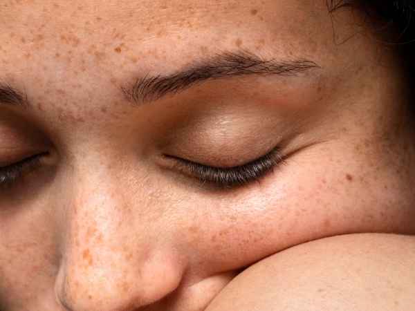 Types Of Skin Diseases on the Face