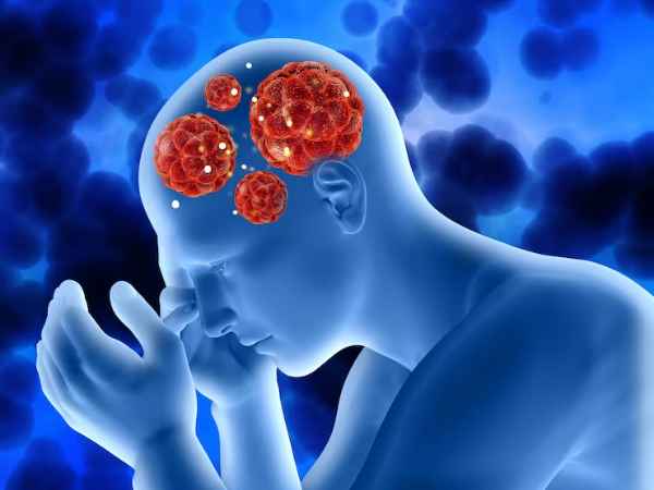Diagnosis & Treatment for Brain-Eating Amoebae