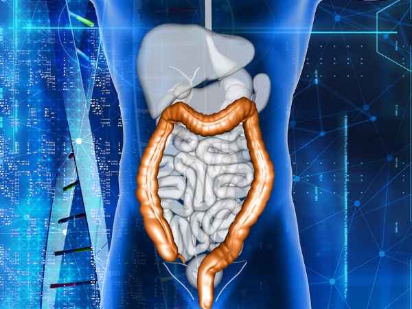 Treatment Options for Gastrointestinal Stromal Tumor