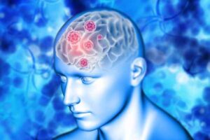 Introduction to Brain Stroke Risk Factors