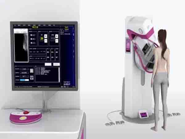 Exploring Digital Mammography Systems