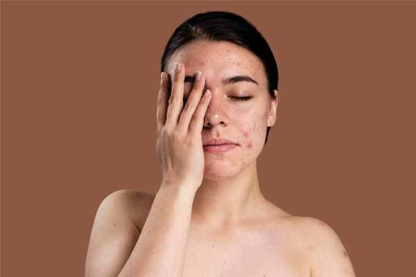 Skin-Discoloration-Common-Concerns-and-Solutions