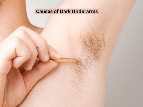 Causes of Dark Underarms