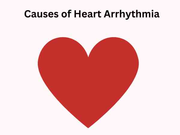 Causes of Heart Arrhythmia