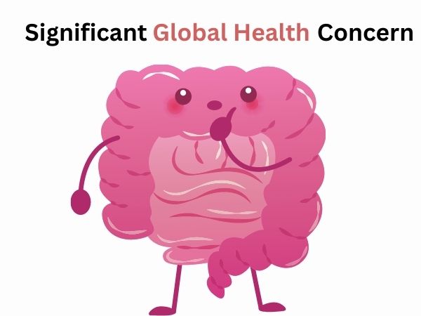Colorectal Cancer as a Significant Global Health Concern