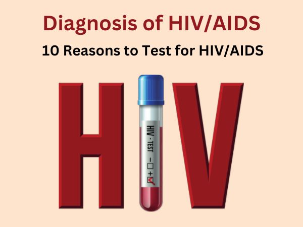 Diagnosis of HIV_AIDS_ 10 Reasons to Test for HIV_AIDS