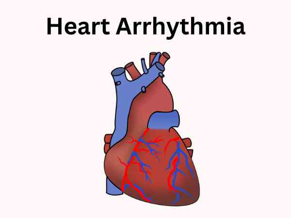 Heart Arrhythmia_ Causes, Symptoms, and Treatment Options