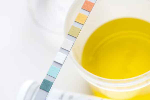 Liver Disease and Urine Color Changes