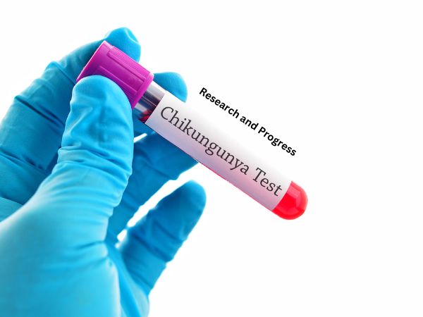 Research and Progress Chikungunya fever