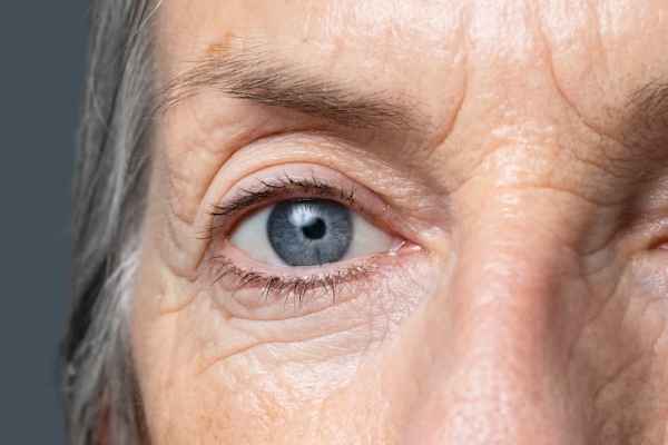 The Need for Cataract Surgery