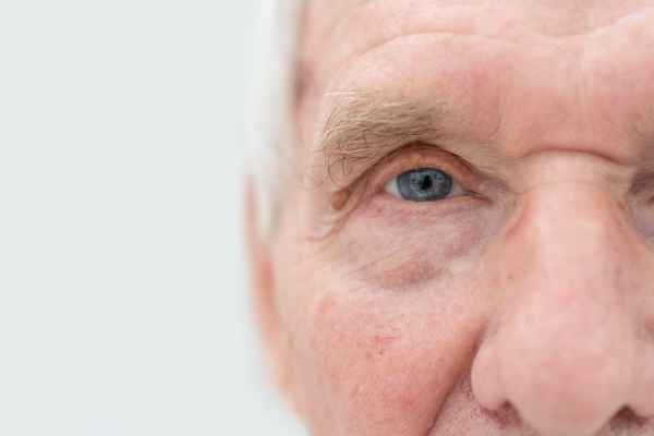 Types of Cataract Surgery